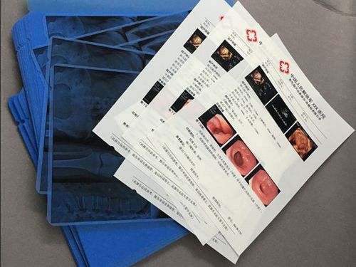 Inkjet White Medical Film (Ultrasound Film/X-Ray Film)