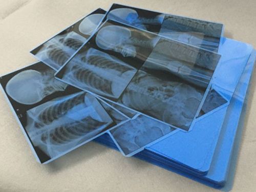 Inkjet Blue Medical Film